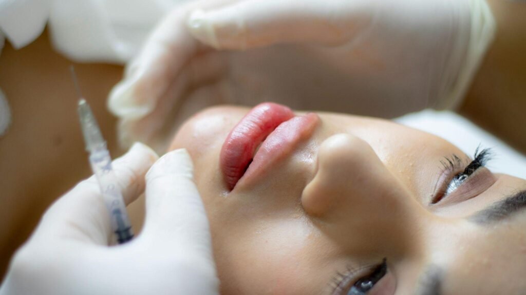 k-clinic lip filler